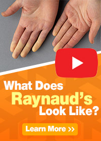 What Does Raynaud's Disease Look Like?